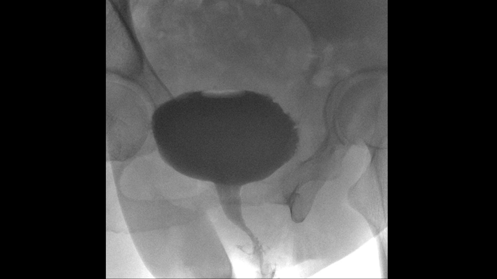 Urology device Uroskop Omnia Max