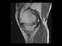 Sagittal PD TSE-MAGNETOM Vida