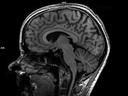 Sagittal MPRAGE-MAGNETOM Terra