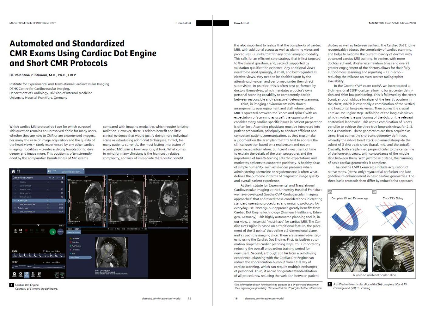 Automated and Standardized CMR Exams Using Cardiac Dot Engine and Short CMR Protocols