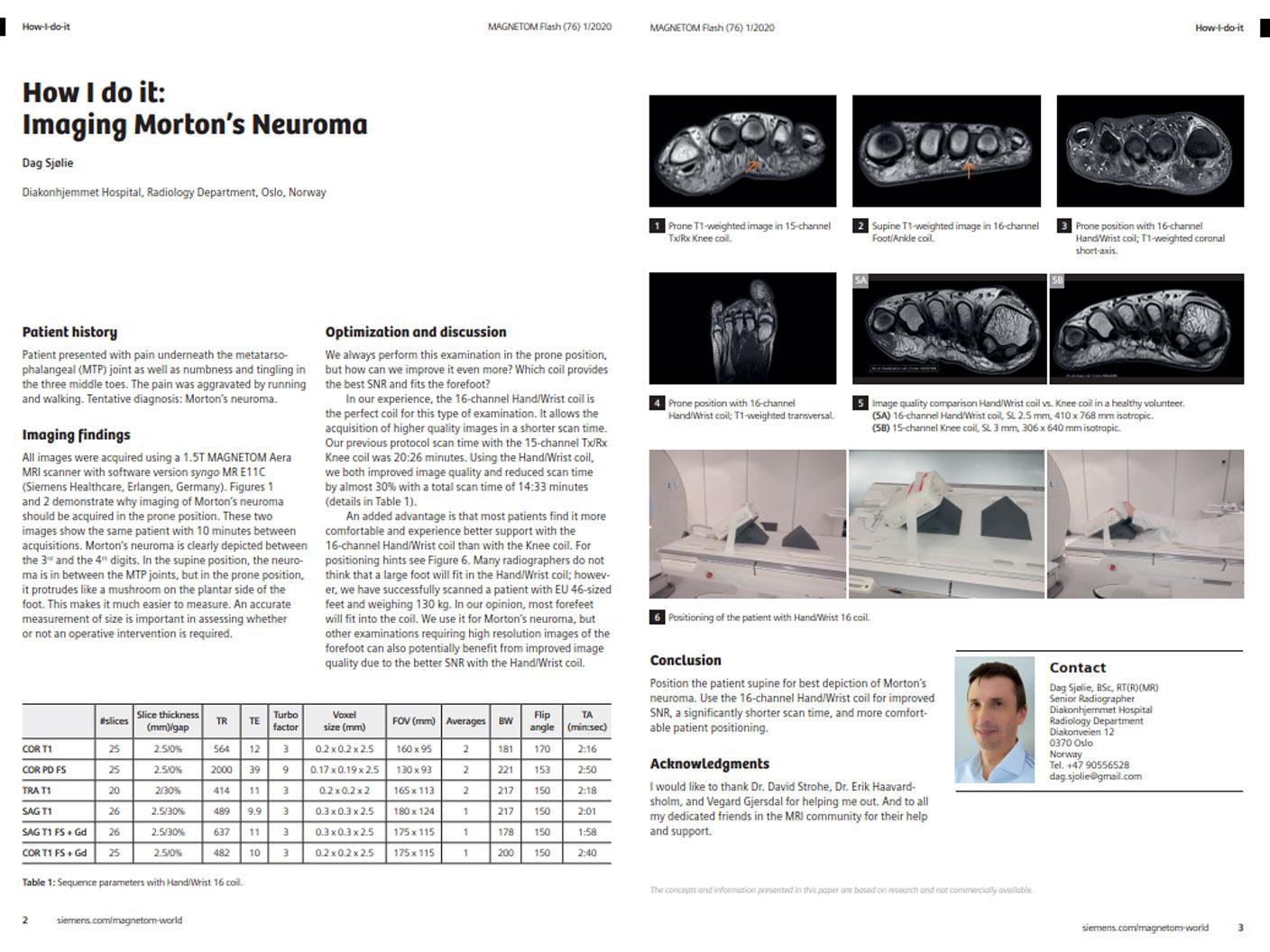 How I do it: Imaging Morton’s Neuroma