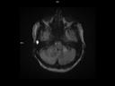 Axial HASTE Diffusion-MAGNETOM Altea