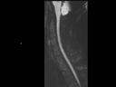 Sagittal Resolve Diffusion 600b-MAGNETOM Altea