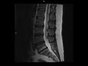 Sagittal T2 tse-MAGNETOM Altea