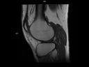 Sagittal T1 tse-MAGNETOM Altea