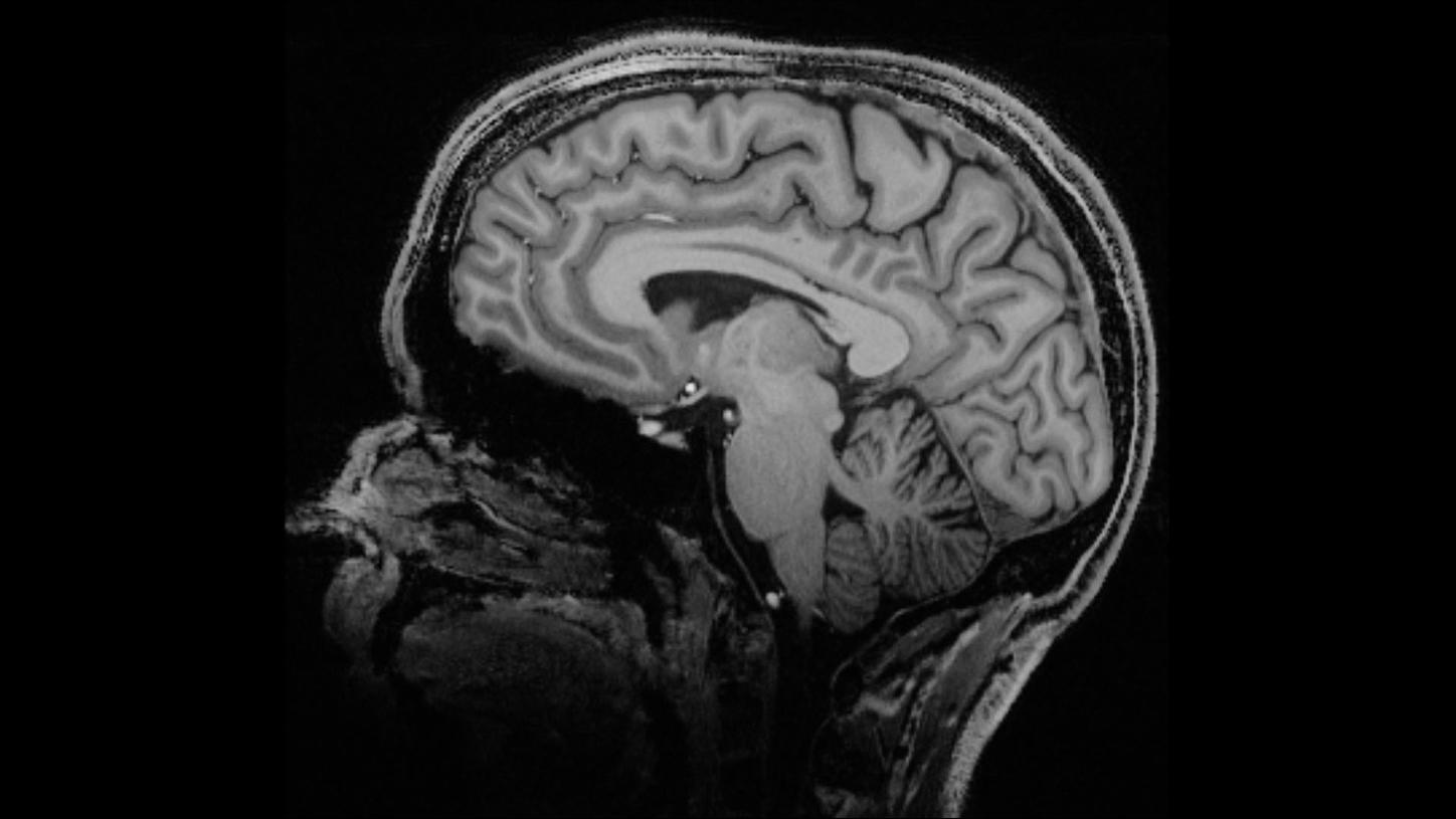 Magnetom Terra 7t Mri Scanner