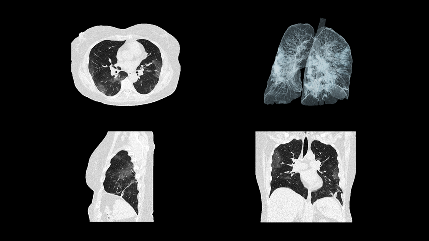 Our response to the COVID-19 pandemic
