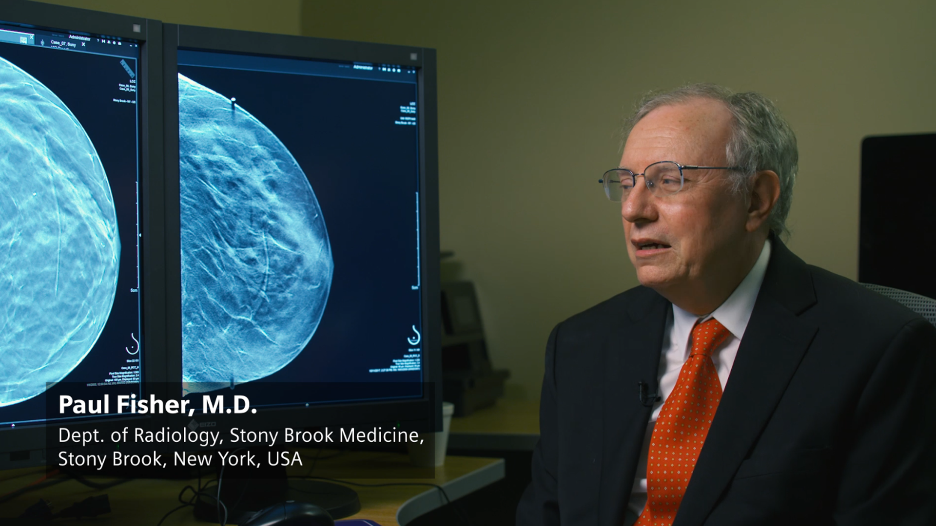 Mammography Testimonials Webinars Clin Talks Mammography Testimonials Webinars Clin Talks