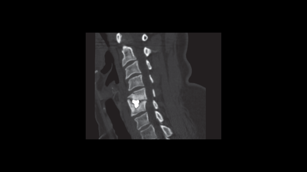 The use of SPECT/CT in a musculoskeletal Physical Medicine and ...