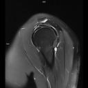 Sagittal T2 FS BLADE-MAGNETOM Altea/Coil-SHA16/Resolution-384/Scan Time-2:03/Aceleration-p2
