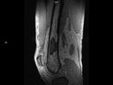 Sagittal T1 GRE .45iso-MAGNETOM Terra