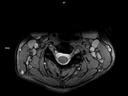 Axial MEDIC-MAGNETOM Lumina/Coil-HeadNeck 20/Spine 24/Resolution-640/Scan Time-4:10