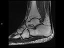 Sagittal T1 TSE-MAGNETOM Lumina