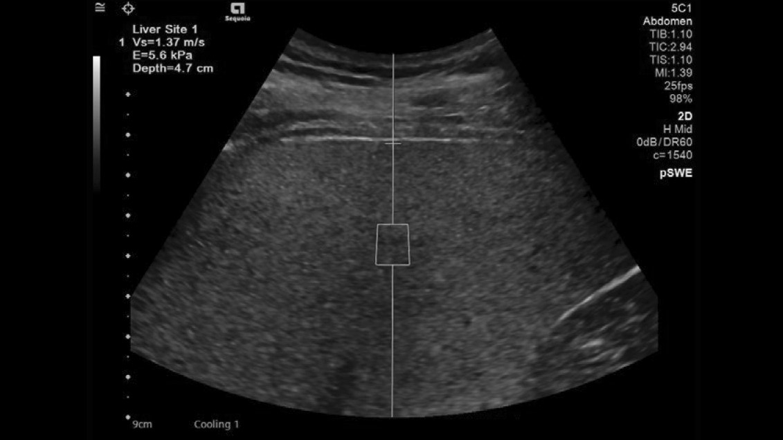 Pediatric Ultrasound System