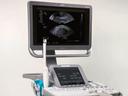 Scan smarter with the ACUSON NX3 ultrasound system