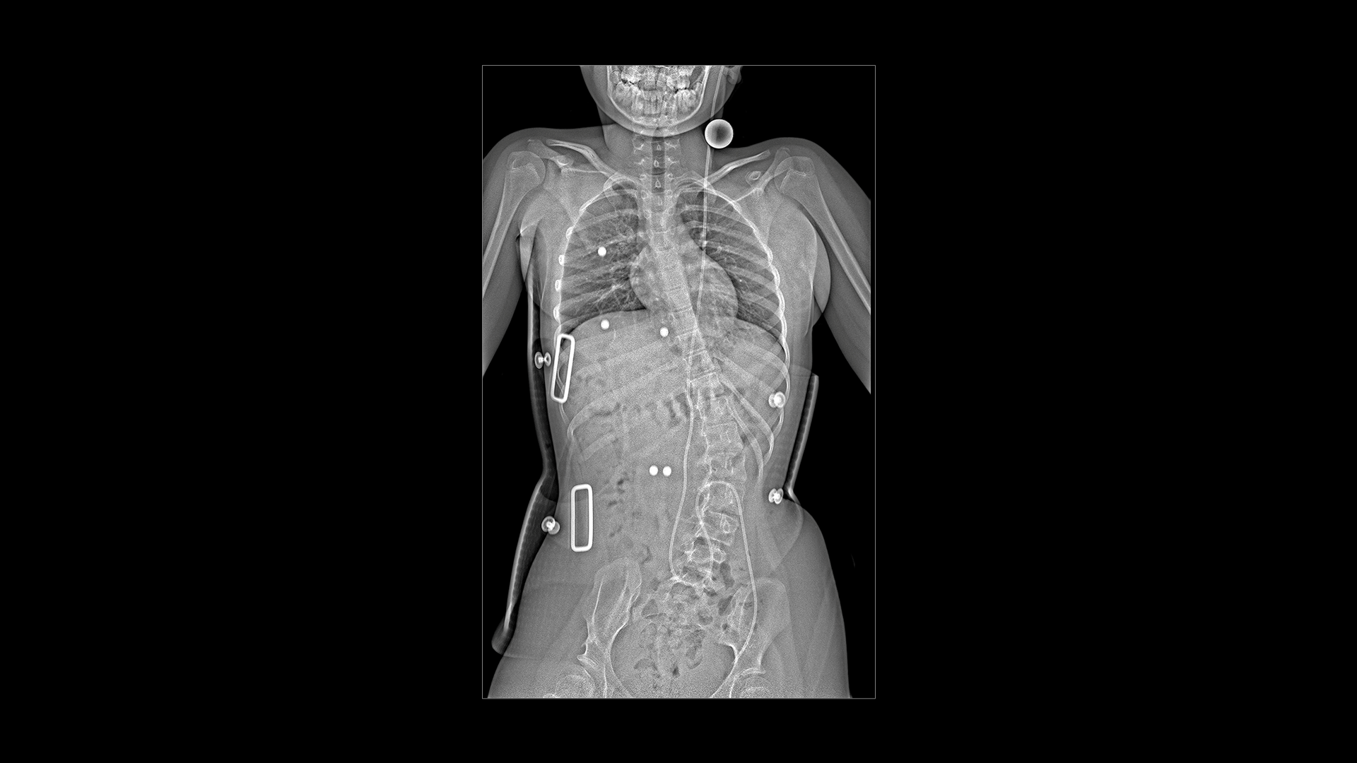 Twin Robotic X-ray scanner – Multitom Rax