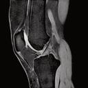 DESS knee imaging
