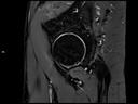 Sagittal PD FS-MAGNETOM Lumina