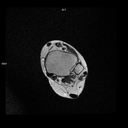 Axial T2-MAGNETOM Free.Max/Coil-Contour Small/Resolution-768/Scan Time-3:50/Aceleration-DRS