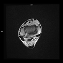 Axial T2-MAGNETOM Free.Max/Coil-Contour Small/Resolution-400/Scan Time-3:37/Aceleration-s2