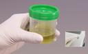 Preparing to run an hCG test