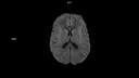 ep2D FS AX MDDW12 B800-MAGNETOM Sola/Coil-HeadNeck 20/Resolution-160/Scan Time-0:00