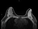 Axial dynaVIEWS-MAGNETOM Lumina/Coil-Sentinelle 16/Resolution-448/Scan Time-1:34/Aceleration-p3
