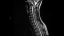 T2 TSE SAG-MAGNETOM Sola/Coil-HeadNeck 20/Resolution-384/Scan Time-3:08