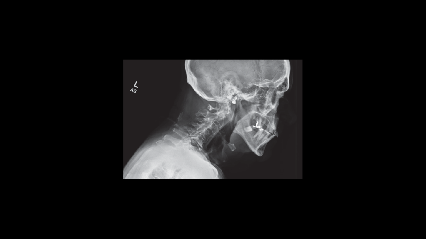 The use of SPECT/CT in a musculoskeletal Physical Medicine and ...