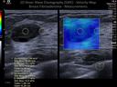 Breast Velocity Map