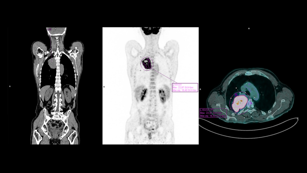 Harmonizing SUV with EQ•PET
