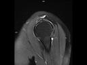 Sagittal T2 FS BLADE-MAGNETOM Altea