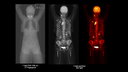 Biograph Vision Quadra Case image