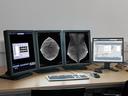 syngo.Breast Care