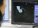 Angiography, Cardiology, Interventinal Cardiology, Coronary Artery Disease, automatic segmentation, centerline extraction