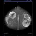 syngo.Breast Care