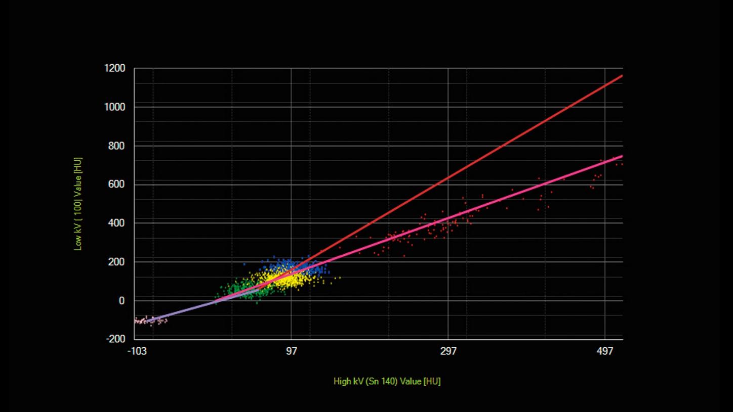 frontier bolsa options