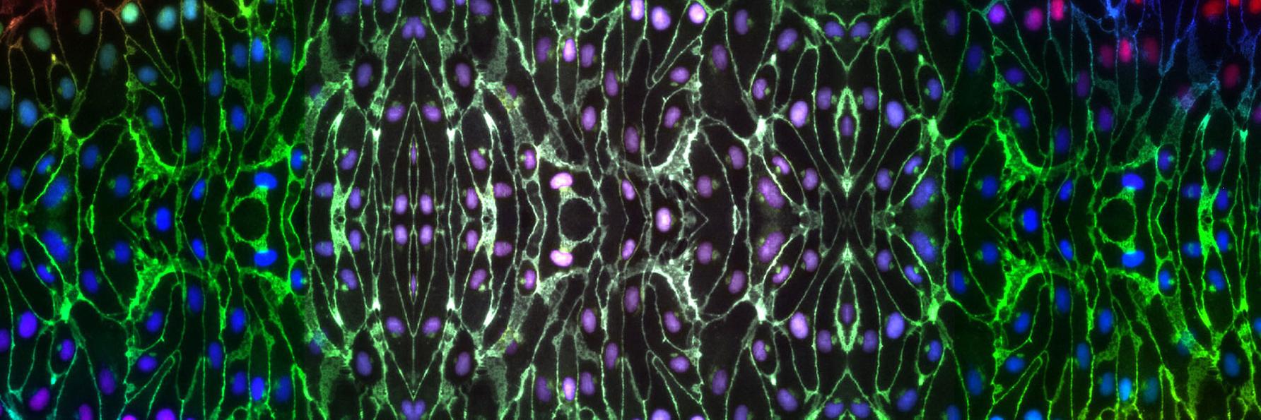iPSC-derived-endothelial-cells.jpg iPSC derived endothelial cells