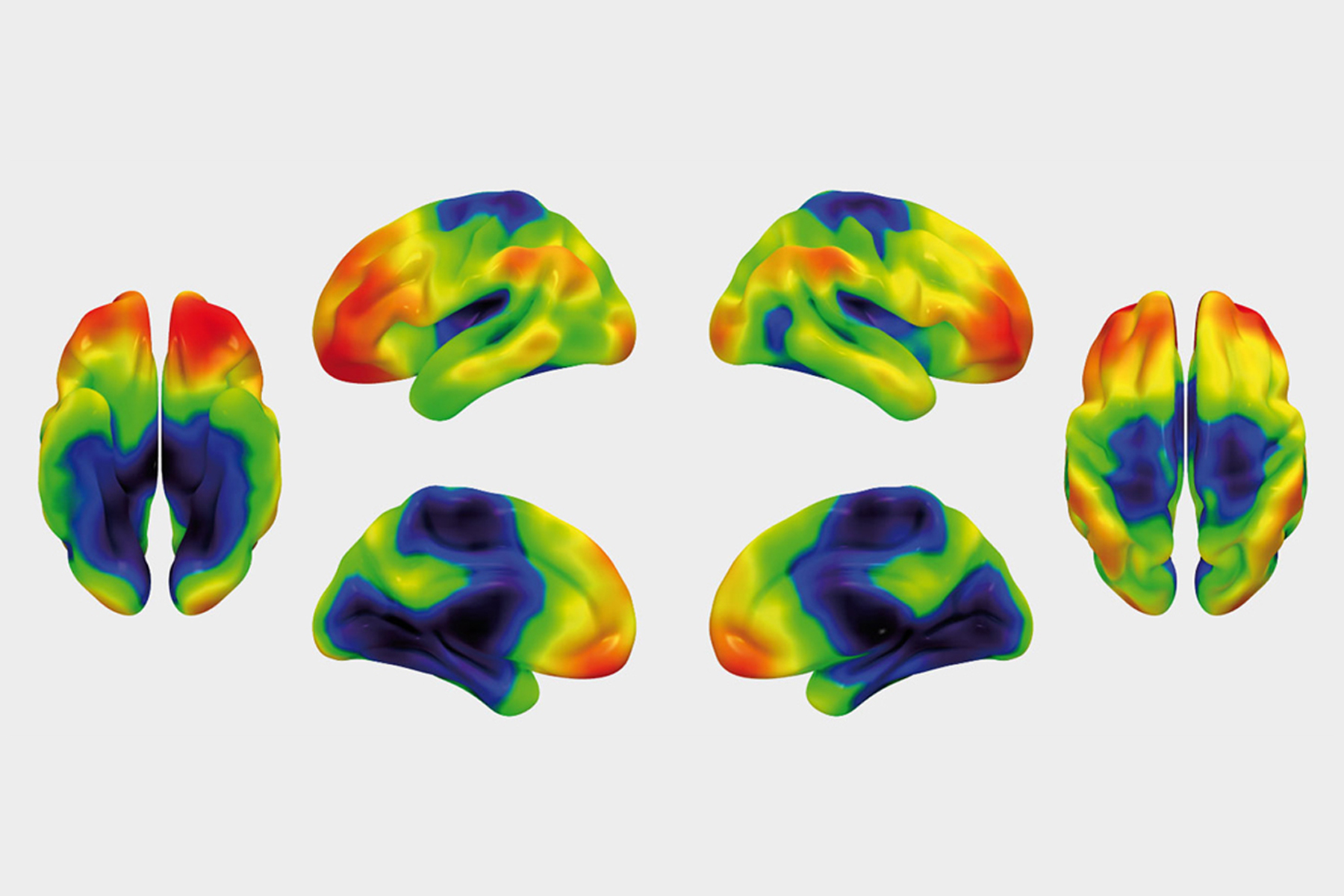 Brainimaging2