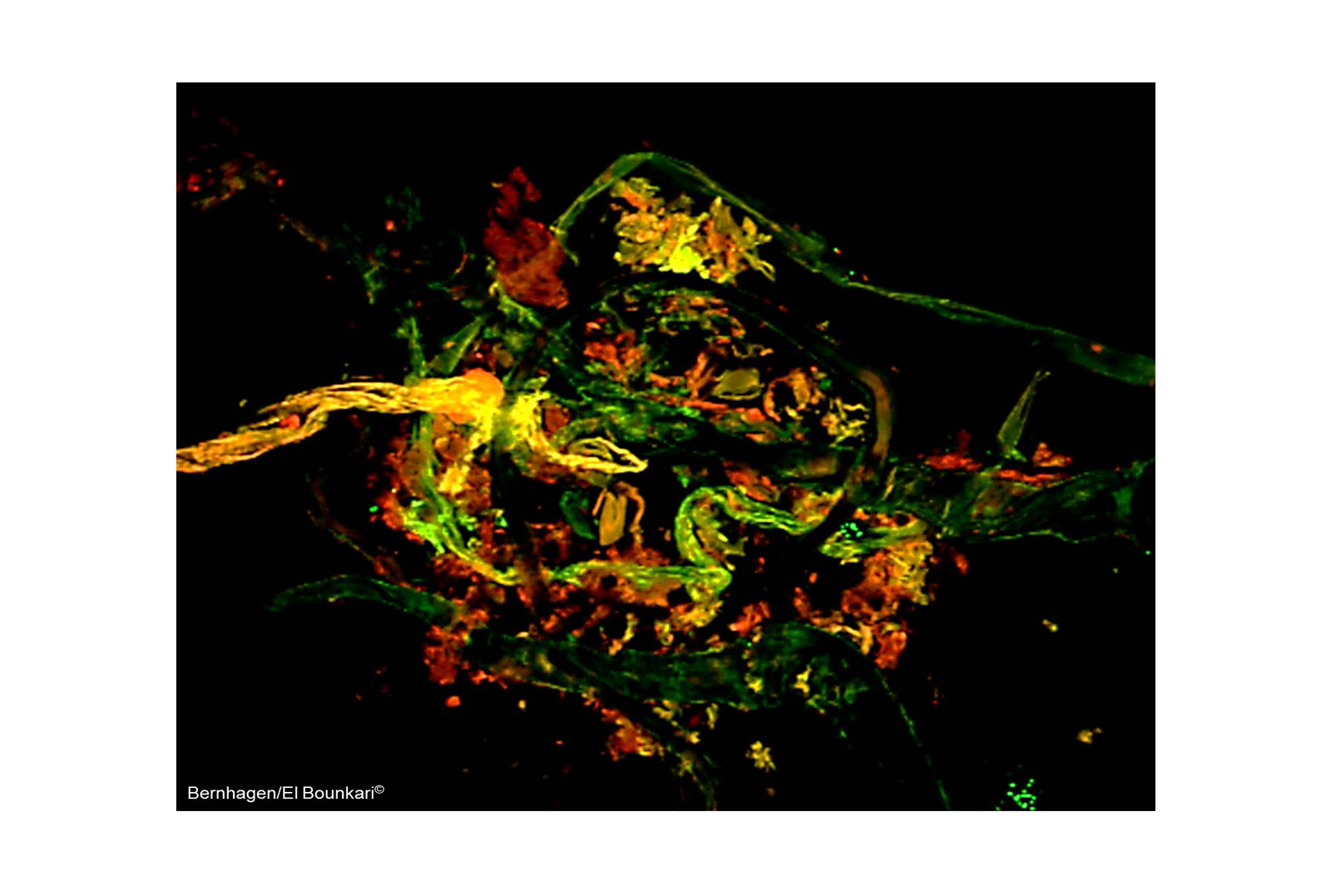 Multi-photon microscopy Multi Photon Microscopy