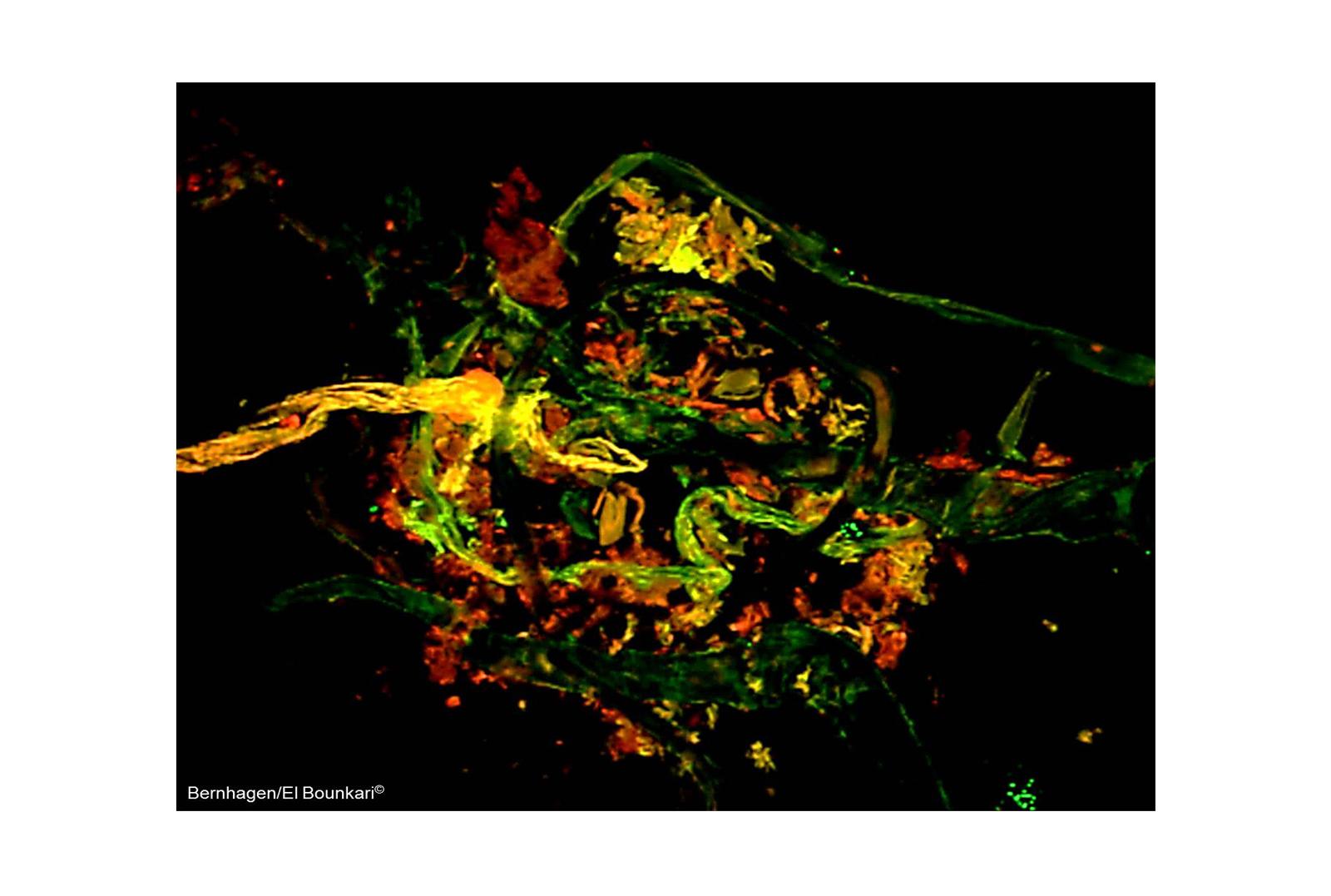Multi-photon microscopy Multi Photon Microscopy