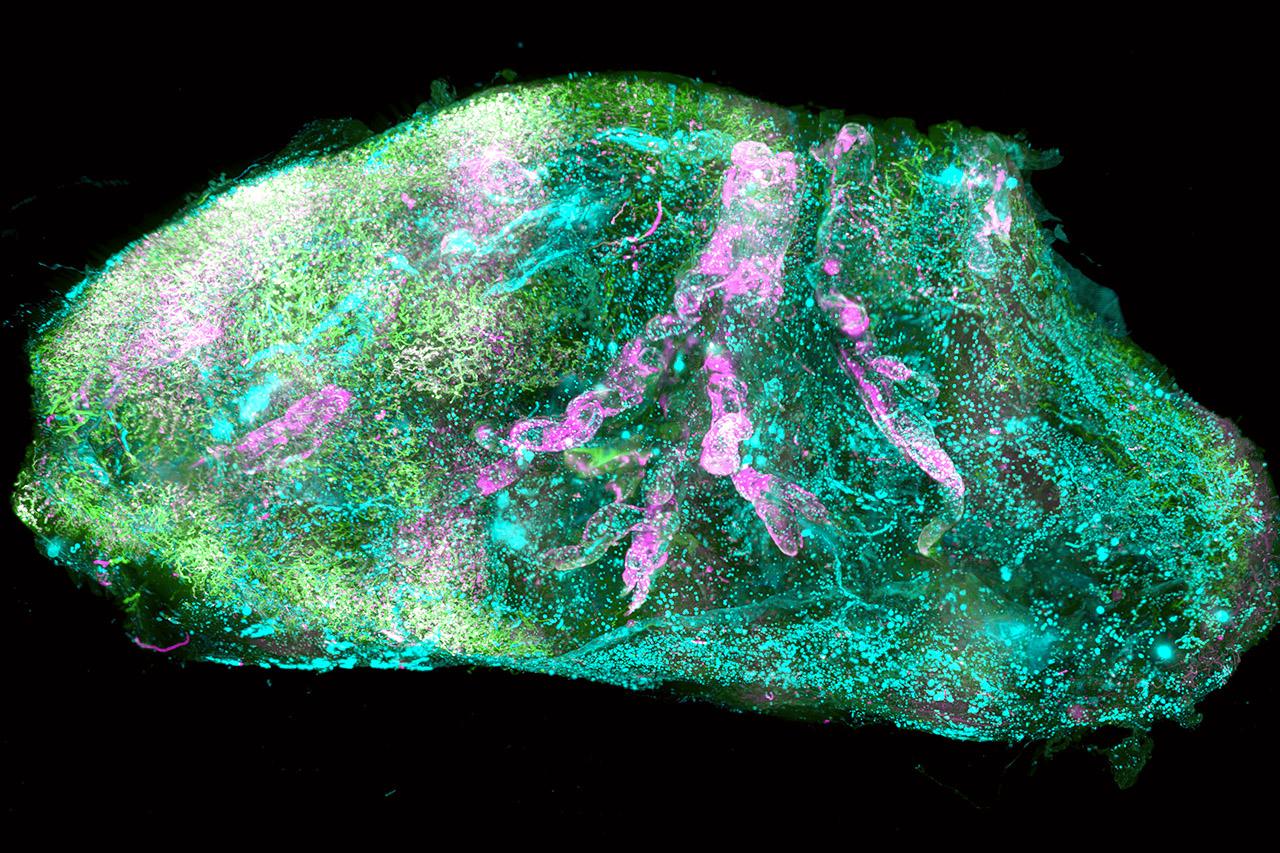Eine menschliche Niere. Aufgenommen mit Light-Sheet Mikroskopie, in der sogenannten „SHANEL“ Methode, welche im Erturk-Lab entwickelt wurde. 3D-Bild eines transparenten Organs (Niere)