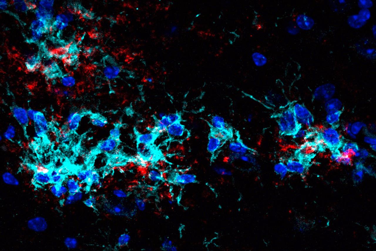 Stimulierte Mikroglia (cyan), die sich um Ablagerungen von Proteinen – sogenannte Plaques (rot) - sammeln und diese abbauen. Die Kerne von Mikroglia und von Nervenzellen erscheinen dunkelbau. Bildquelle: DZNE/LMU München/Haass Lab