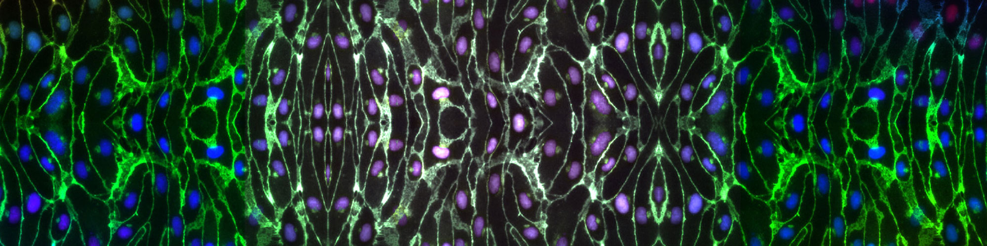 Ipsc derived endothelial cells