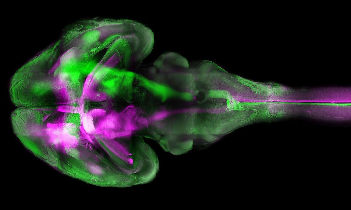 Das Gehirn einer Maus - aufgenommen mit hochauflösender Fluoreszenz-Mikroskopie mittels "Tissue Clearing" - einer Technik, die jetzt mit zwei Farbstoffen kombiniert eingesetzt wurde und damit erstmals die großen und kleinen Gehirngefäße gleichzeitig sichtbar gemacht hat. © Ertürk Lab / ISD