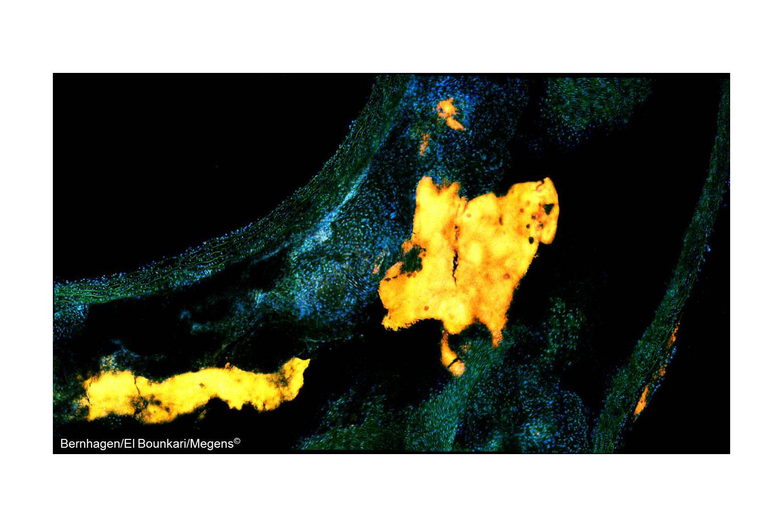 Multi-photon microscopy Multi Photon Microscopy