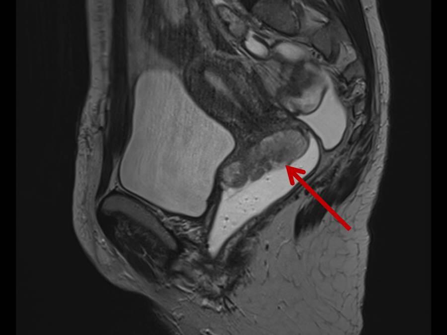 Klinik und Poliklinik für Radiologie | Bauch & Becken