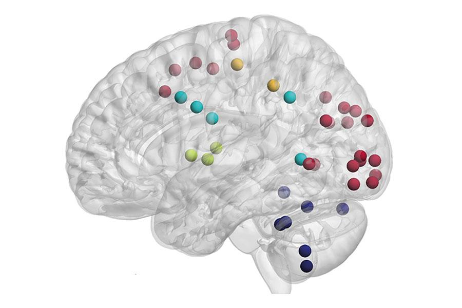 The contribution of acute infarcts to cerebral small vessel disease progression