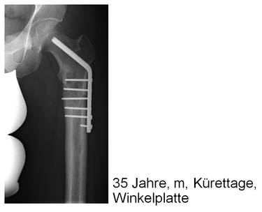 Image ohne Titel