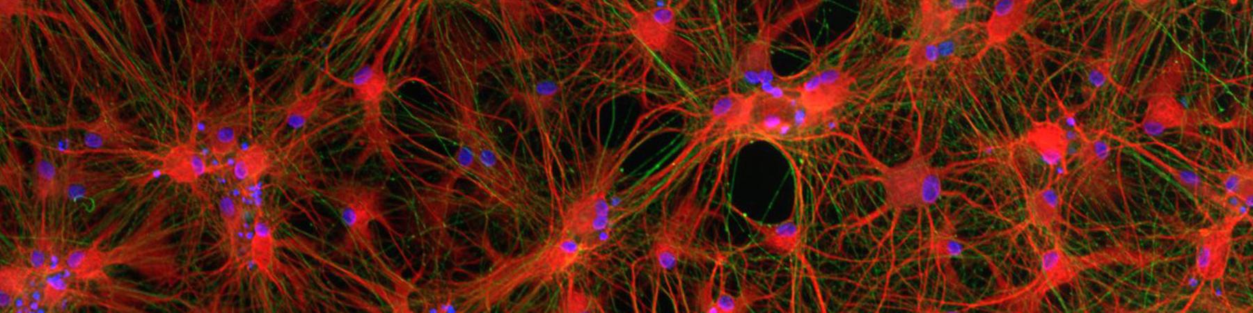 iPSC derived astrocytes iPSC derived astrocytes